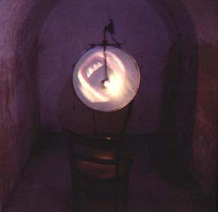 Membrain Tympani - total